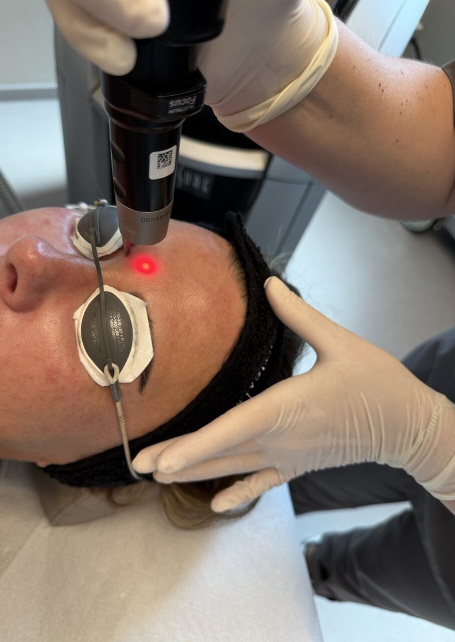 NatureLift Potsdam – innovative Kombination aus Laser und regenerativer Hauttherapie für ein jugendliches, frisches Hautbild bei Dr. Jasmin Last