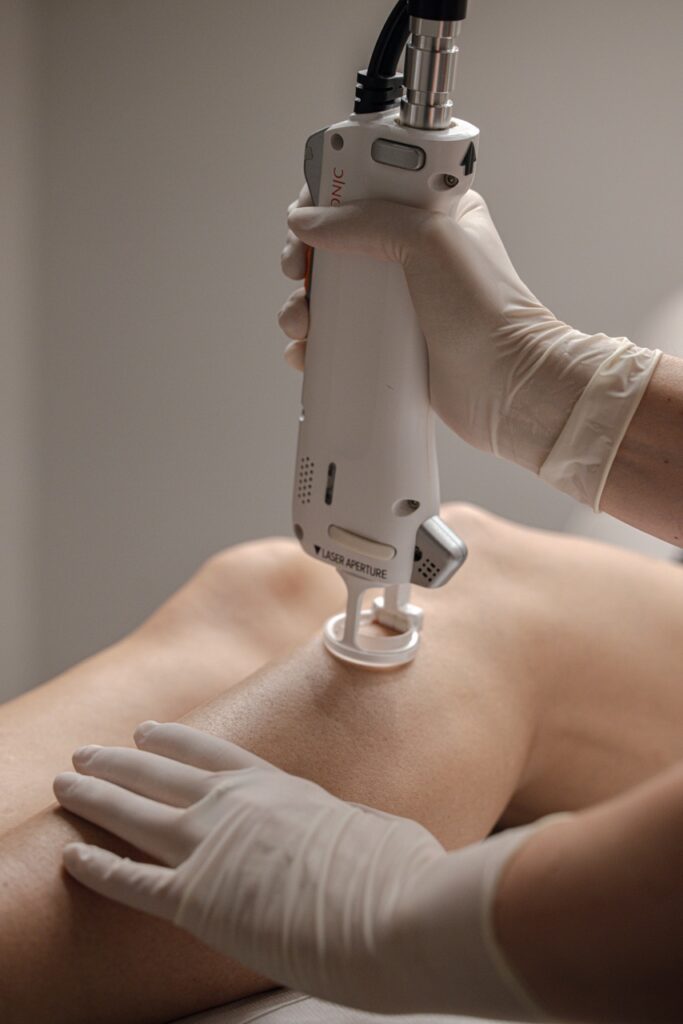 Laser Haarentfernung Potsdam – professionelle Behandlung der Beine mit moderner Lasertechnologie bei Dr. Jasmin Last