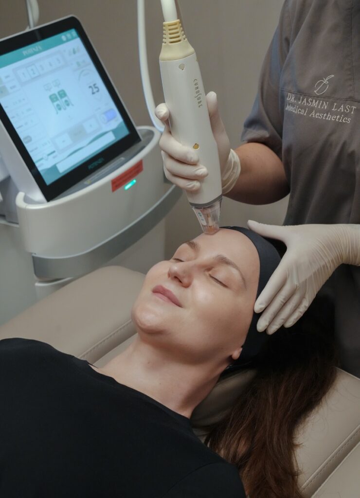 PicoGlow Behandlung Potsdam – Hautstraffung, Porenverfeinerung und Kollagenaufbau durch präzise Laserenergie bei Dr. Jasmin Last