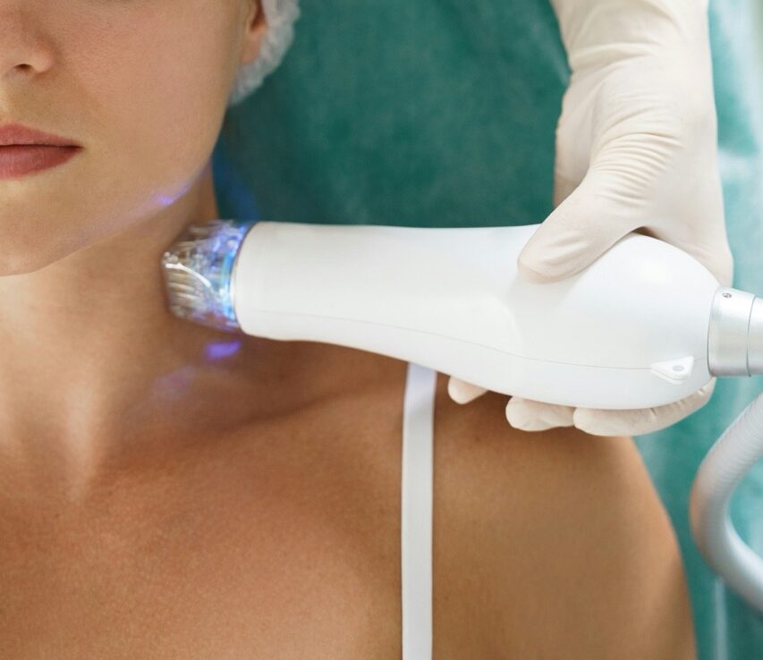 RevFusion Potsdam – minimalinvasive Behandlung zur Straffung und Revitalisierung der Haut durch gezielten Kollagenaufbau bei Dr. Jasmin Last