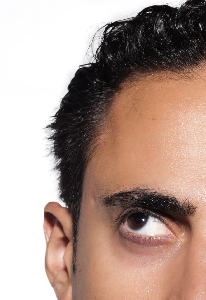 Schlupflider entfernen Potsdam – effektive Oberlidstraffung für frische, offene Augen bei Dr. Jasmin Last